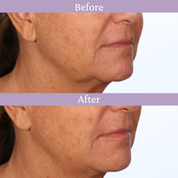 Ageless Jawline Uplift Serum