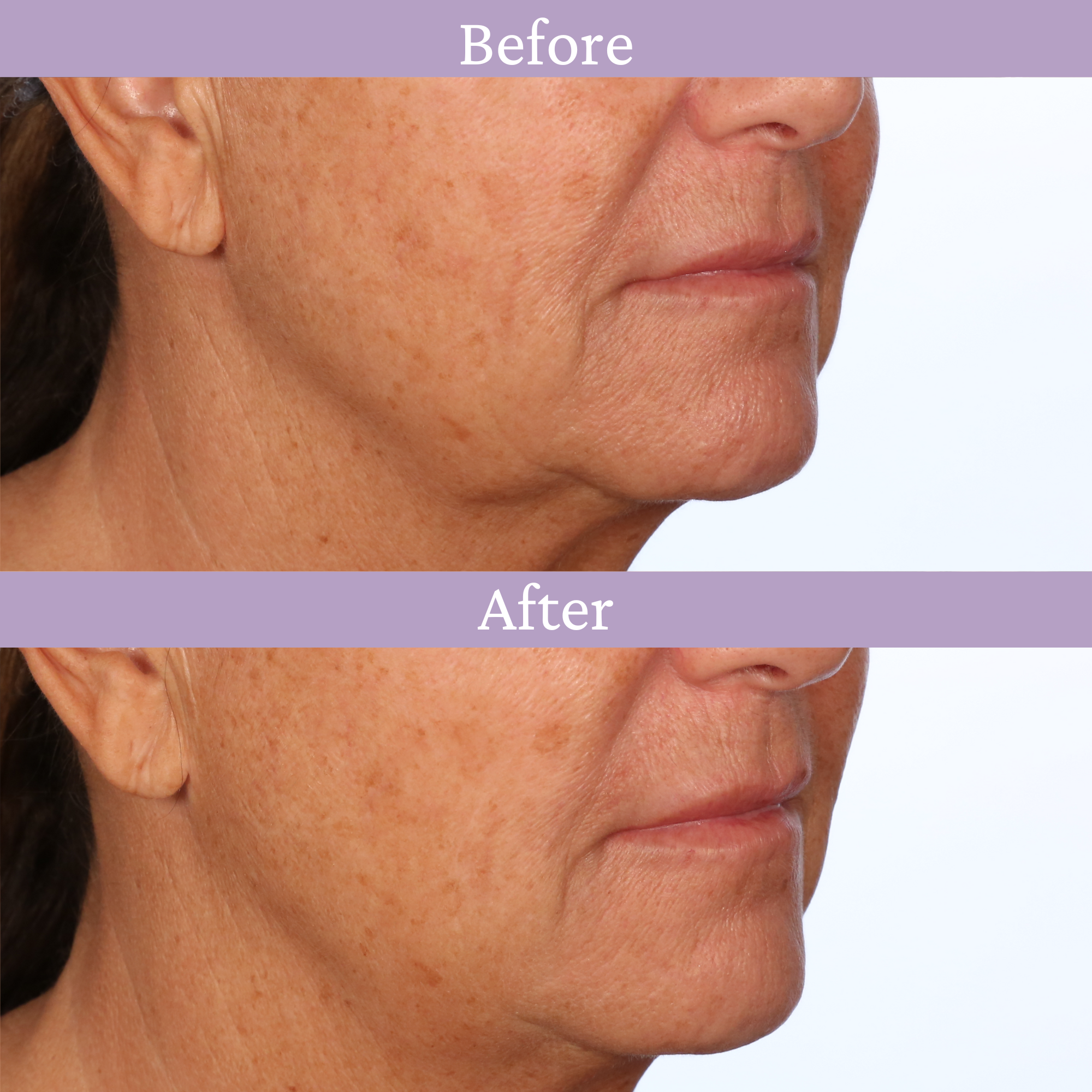 Ageless Jawline Uplift Serum