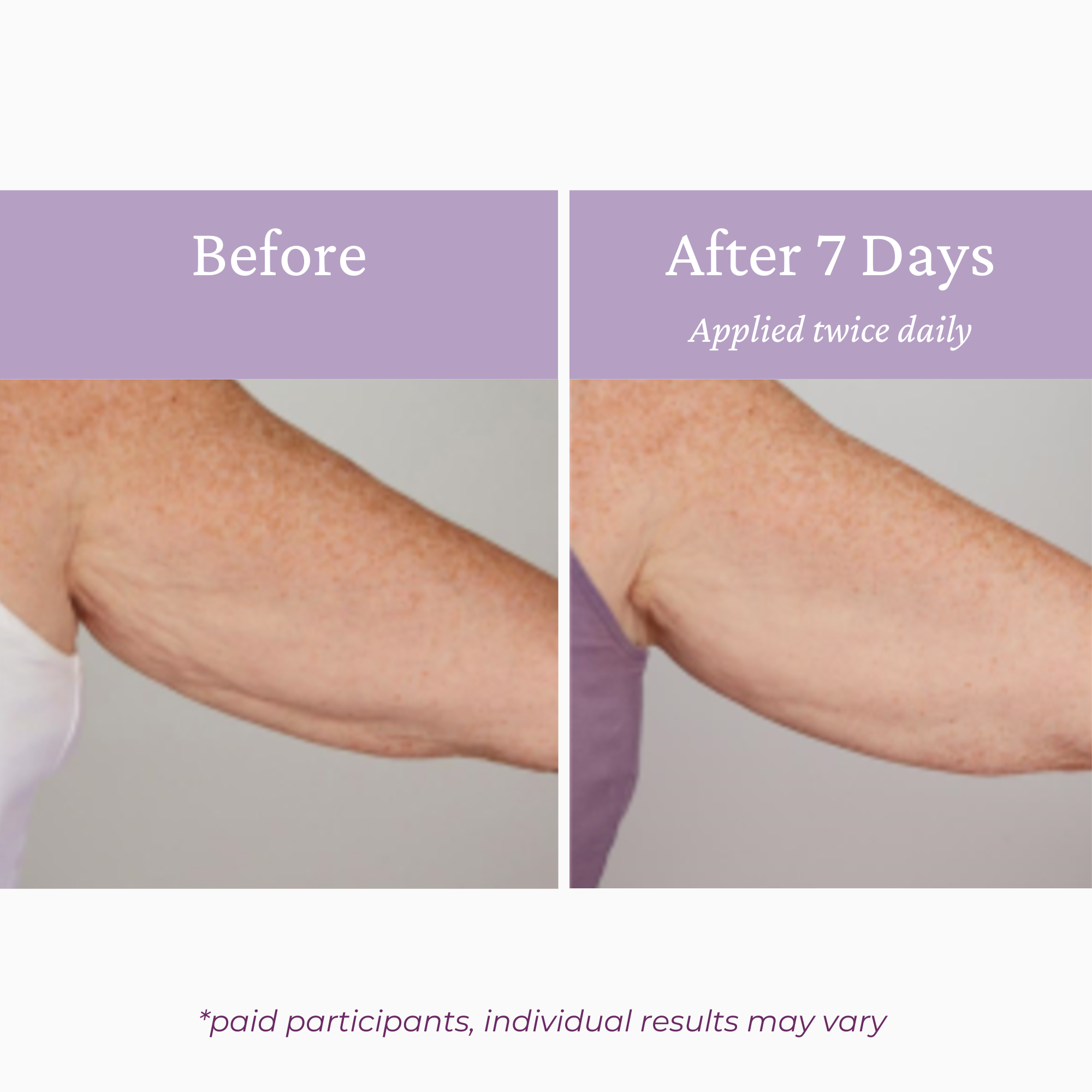 Ageless Upper Arm Creme