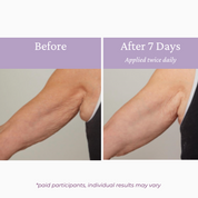 Ageless Upper Arm Creme