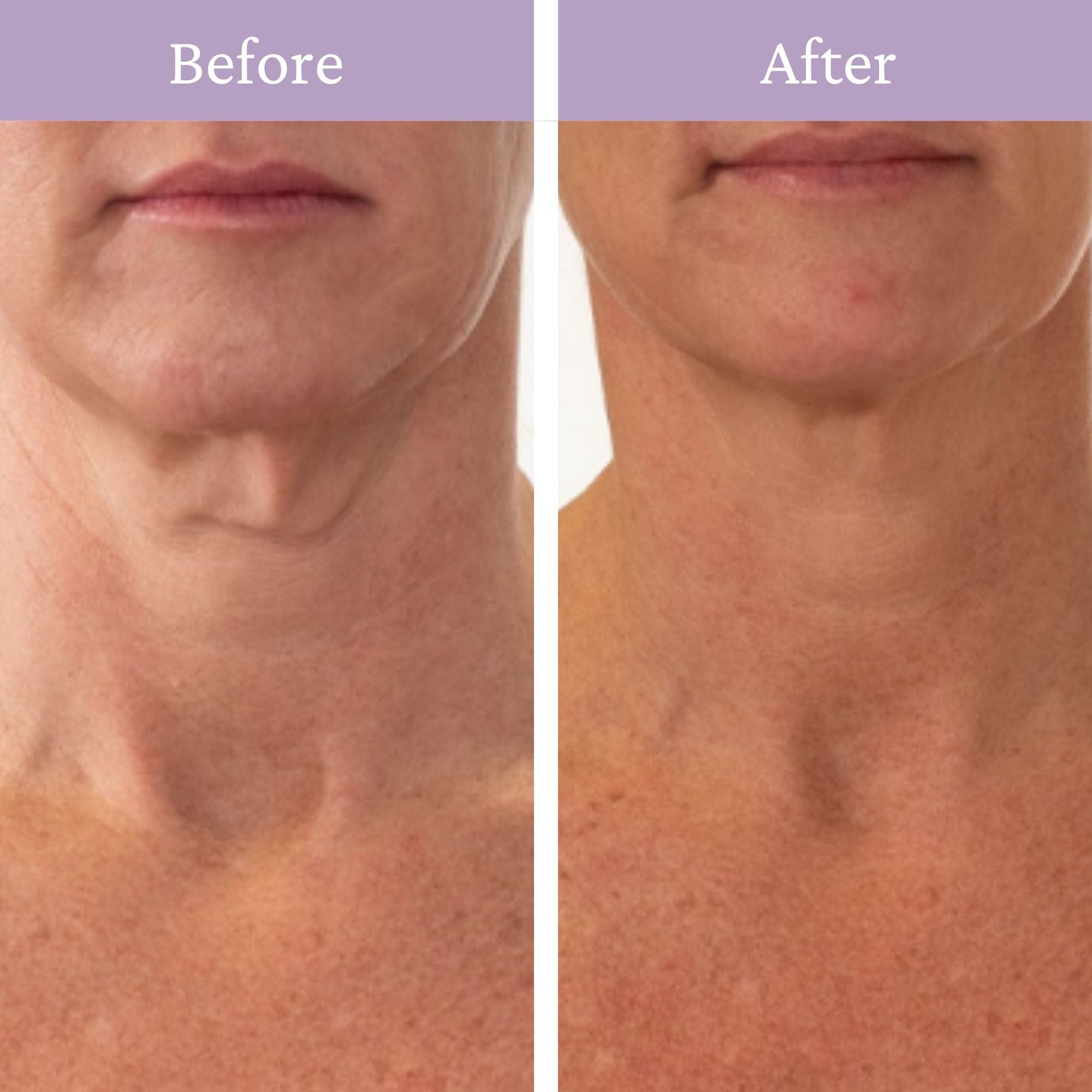 Ageless Throat & Decolletage Creme