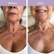 Ageless Throat & Decolletage Creme